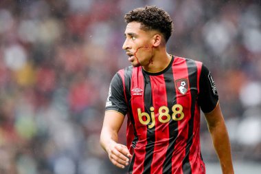 * * * EDITORS NOTE - grafik içeriği * * AFC Bournemouth 'dan James Hill, Tottenham Hotspur ile Bournemouth arasındaki Premier League maçında sakatlandı.