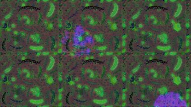 Raster illüstrasyonundaki çiçek desenli çizim. Yeşil, gri ve kahverengi renkte çiçekler.