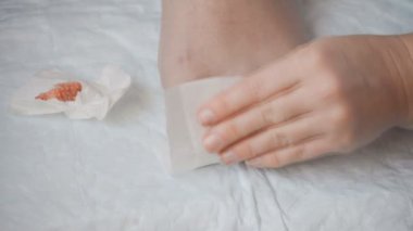 Bu, yaralı bir ayak parmağının ayakkabılarda güvenli bir şekilde kullanılması için sargılandığı görüntüler. Ayak parmağını kapatıyor ve ayak tırnağını düzeltmeye çalışıyor..
