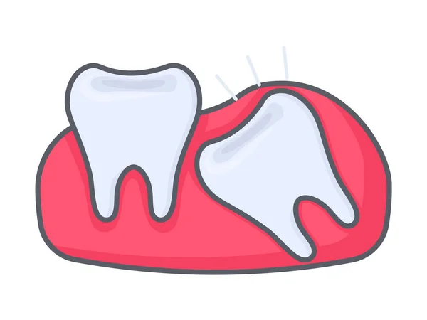 Ząb Mądrości Wpychając Kolejny Ząb Zęby Stomatologii Koncepcja Zęba Płaskim — Wektor stockowy