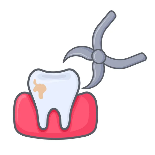 Diş Kıskaç Ile Alınır Diş Implantı Olan Bir Diş Çukuru — Stok Vektör