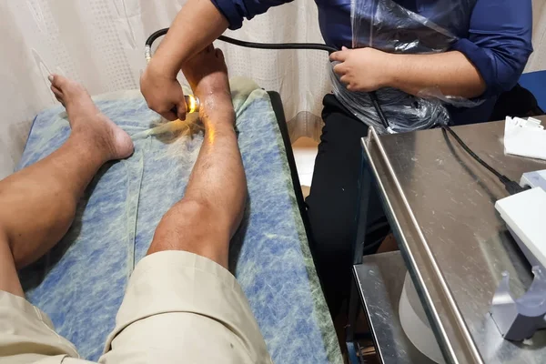 Hastanedeki Şişmiş Ayak Bileğinde Ultrason Tedavisi Uygulayan Bir Terapist — Stok fotoğraf