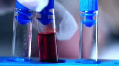 Kan örneği makrosu olan test tüpleri. Yakın çekim, yavaş çekim, seçici odaklanma.