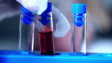 Kan örneği makrosu olan test tüpleri 4k 'lık yakın çekim yavaş çekim seçici odak noktası