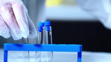 Kan örneği makrosu olan test tüpleri. Yakın çekim, yavaş çekim, seçici odaklanma.