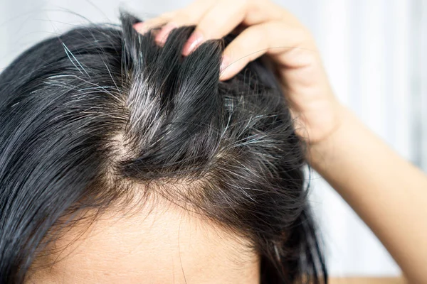Closeup Asian Woman Having Problem Grey White Hair Growing — Stock Photo, Image