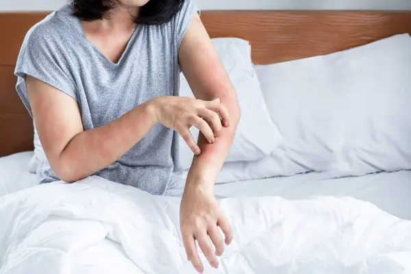 Mulher Tem Problema Com Ácaros Poeira Alergia Cama Mão Coçar Imagem De Stock