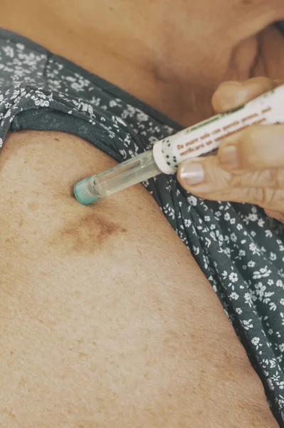 Kadın Kolunu Insülin Kalemle Kapat Olgun Bir Bayanın Diyabet Tedavisini — Stok fotoğraf