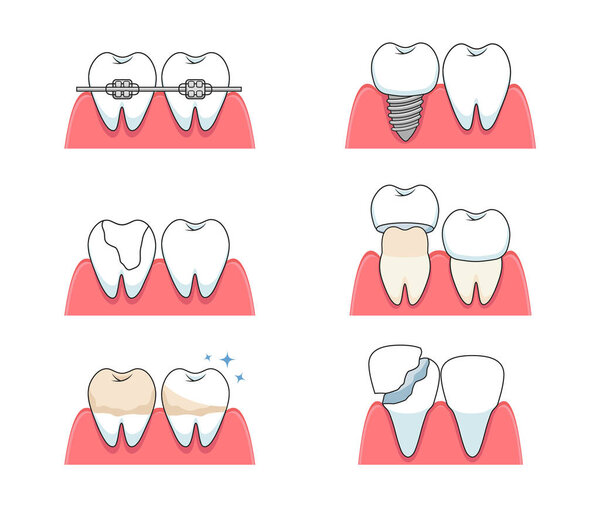 Лечение зубов. Векторная иллюстрация общих стоматологических процедур и ухода