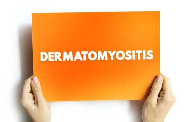 Dermatomyositis Egy Nem Gyakori Gyulladásos Betegség Amelyet Izomgyengeség Jellegzetes Bőrkiütés — Stock Fotó