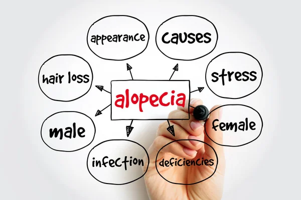 Alopecia Mind Map Medicínský Koncept Pro Prezentace Zprávy — Stock fotografie