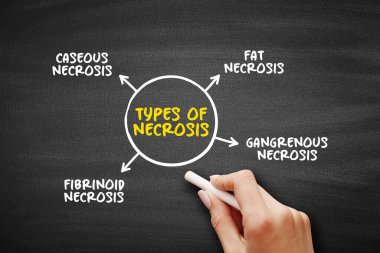Sunum ve raporlar için Nekroz Türleri (vücut dokusunun ölümü) zihin haritası metin kavramı