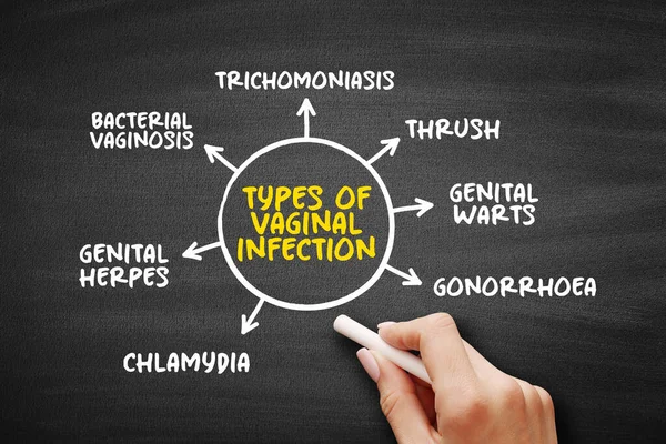 Types Vaginal Infection Mind Map Text Concept Presentations Reports —  Fotos de Stock