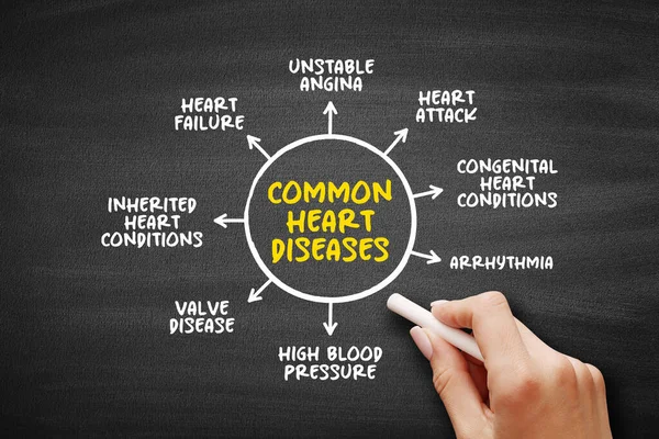 Common heart diseases mind map text concept for presentations and reports