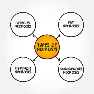 Sunum ve raporlar için Nekroz Türleri (vücut dokusunun ölümü) zihin haritası metin kavramı