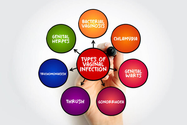 Виды вагинальной инфекции карты разума, текстовая концепция для презентаций и докладов