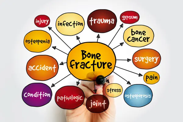 stock image Bone fracture mind map, concept for presentations and reports