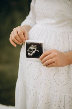 Beyaz tişörtlü hamile bir kız elinde ultrason tutuyor.
