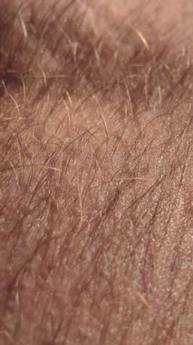 Aşırı yakın plan insan derisinin detaylı dokusunu ve foliküllerden büyüyen kılları gösteriyor. Doğal ışık ince tüyleri yakalar ve vücutların yüzeyi üzerinde hafif bir parıltı yaratır..