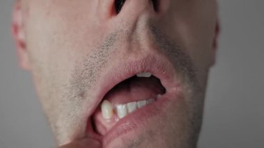 Sakallı, ağzı açık bir adamın makro çekimi. Parmağını alt dudağını çekmek için kullanır, dişlerini, diş etlerini ve dilini diş sağlığı ve ağrı için inceler, tıbbi veya hijyen kavramını gösterir..