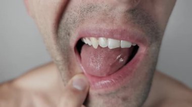 Dudağını parmağıyla geri çekerken, keskin köpek dişlerine diliyle dokunan bir adamın yakın plan görüntüsü. Detaylara göre bir stüdyo ortamında çenesinde diş etleri, diğer dişler ve sakallar var..