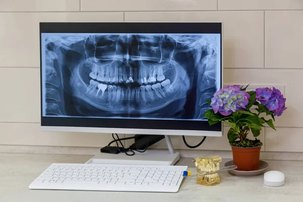 화면에 컴퓨터가 치과의 사무실 엑스레이 항아리 아름다운 — 스톡 사진