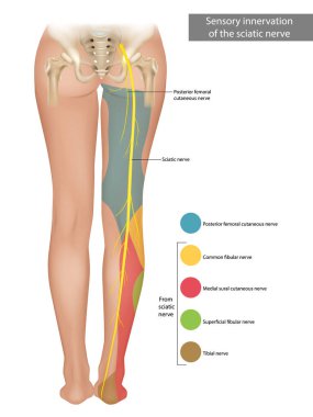 The Sciatic Nerve. Sensory innervation of the sciatic nerve. Sciatica. Medical Illustration clipart