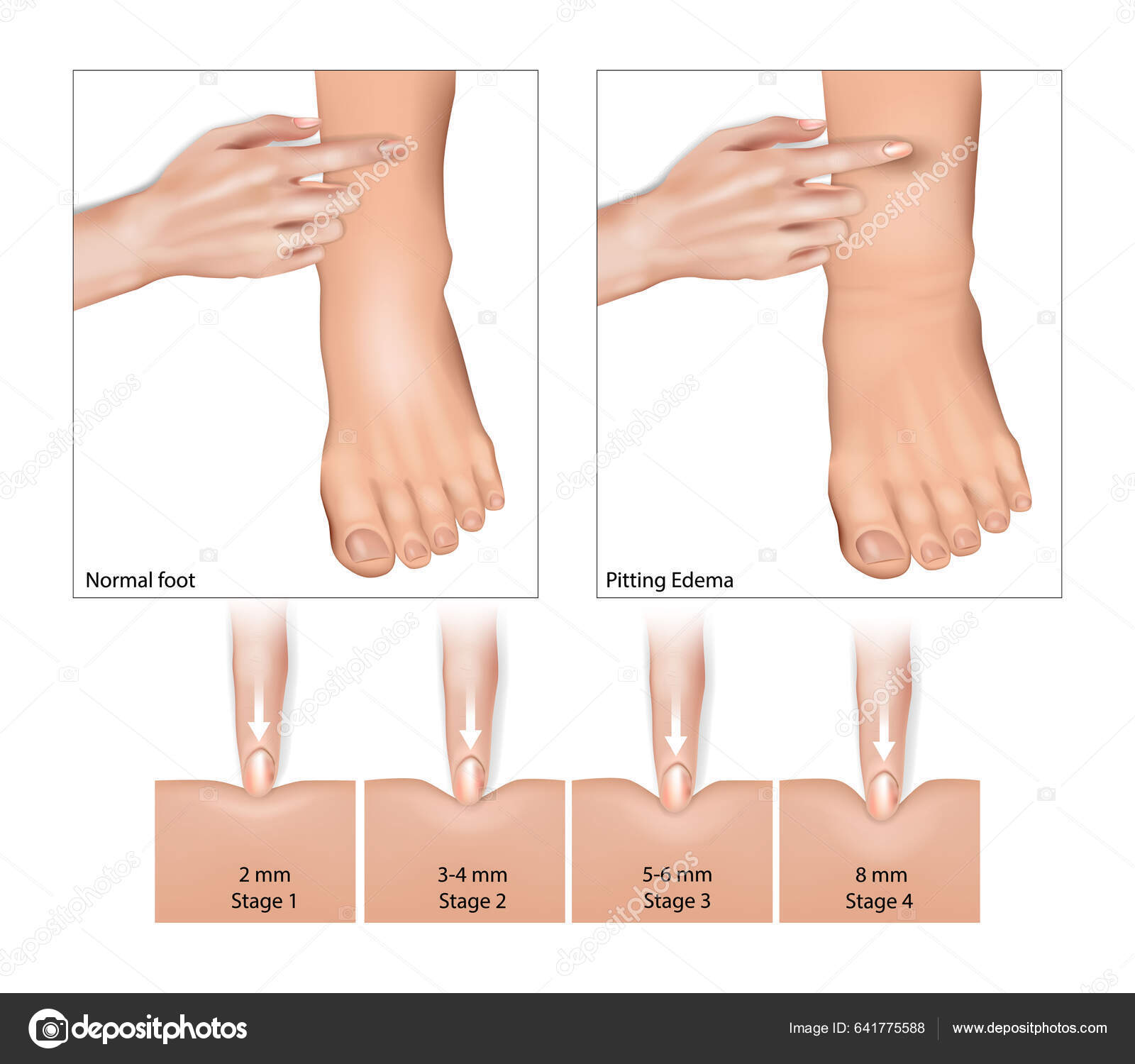 Éxito del tratamiento antiescabiosis: recomendaciones actuales -  Medizinonline, image size:1600x1500