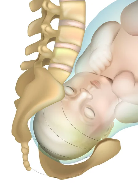 Position Geburtskanal Ansicht Geburtskanal Mensch Weibliches Becken Für Die Geburt — Stockvektor