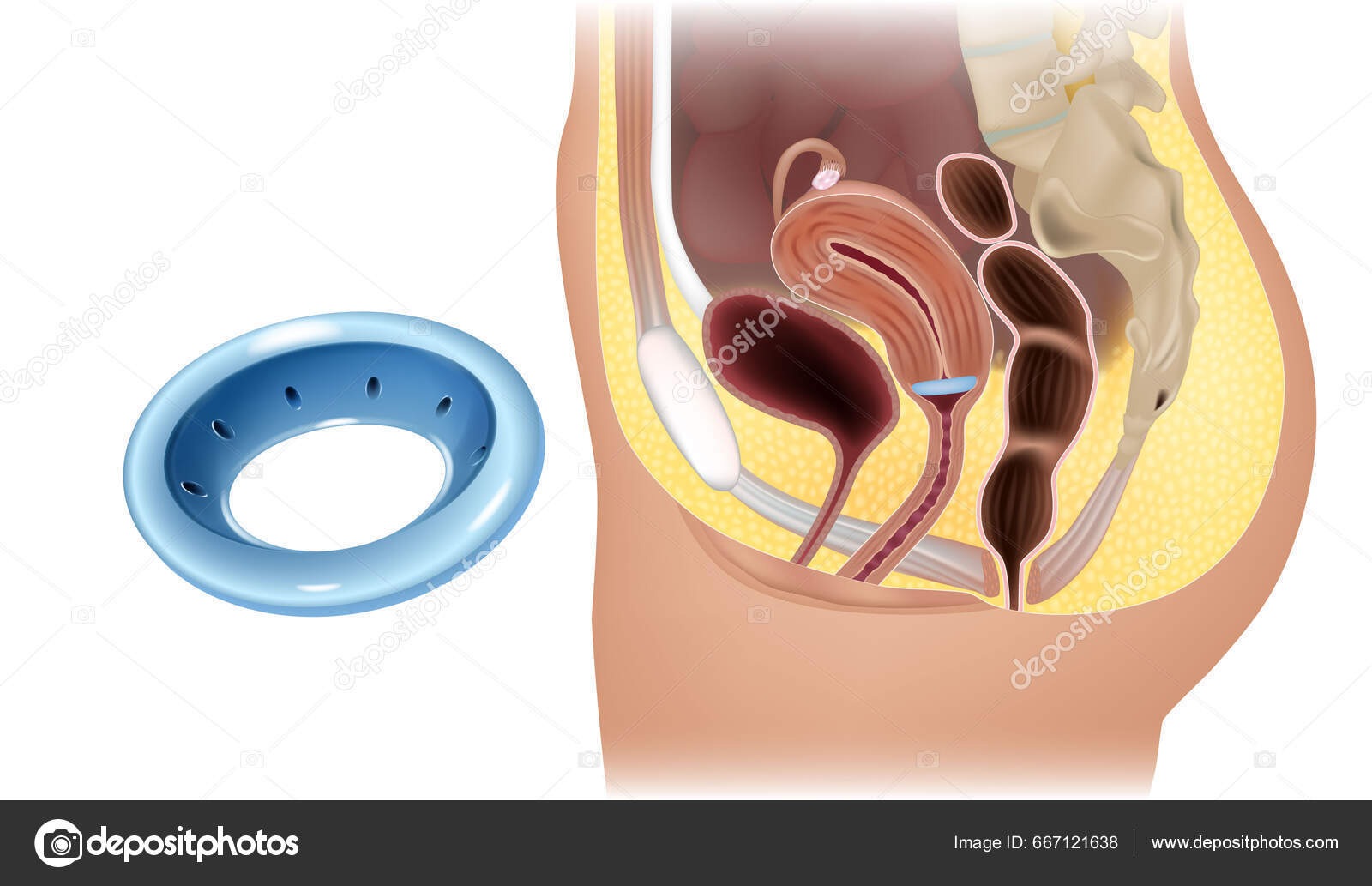 Savodsiz onalar porno