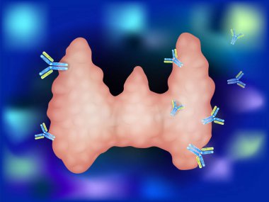 Tiroid bezine saldıran antikorları gösteren illüstrasyon. Otoimmün tiroidit, Hashimoto hastalığı. Otoimmün