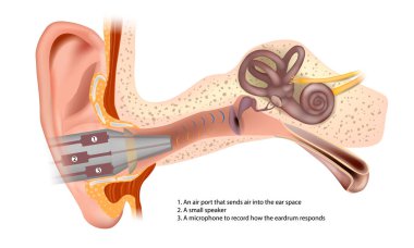 Timpanometri. Yanıt Kulak Testi. Hava pompası manometresi, Mikrofon yükselticisi ve dağıtım tonu