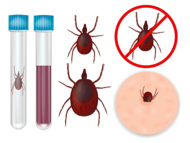 Ixodida or ticks. Tick-borne encephalitis and Lyme borreliosis vaccination. clipart