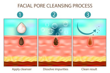 Eğitimsel bilgiler, yüz gözenek temizleme sürecinin üç aşamada olduğunu gösteriyor. Temizleyici uyguluyor, safsızlıkları eritiyor ve temiz bir cilt elde ediyor. Yüz İçi Temizleme Adım Adım Temizleme