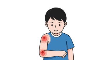 Çocuk, cilt durumu ve enfeksiyonundan dolayı rahatsız.