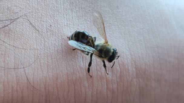 Sengatan Lebah Pada Kulit Manusia — Stok Video