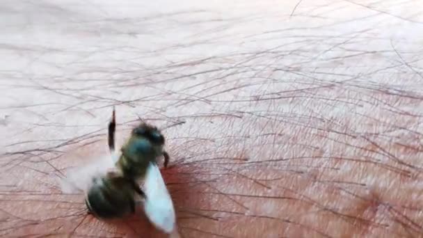 Укус Пчелы Коже Человека — стоковое видео