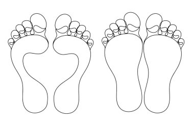 Normal insan ayağı ve düz taban. Ayak deformasyonu. İnsan ayak izi. Dünya Yumru Ayak Günü. Farklı kullanım alanları için bir çizgi. Vektör illüstrasyonu.