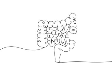 Bağırsağın bir kısmını almak ve stoma yaratmak için ameliyat. Bir insanın hayatını kurtarmak. Ostomy Farkındalık Günü. Farklı kullanım alanları için bir çizgi. Vektör illüstrasyonu.