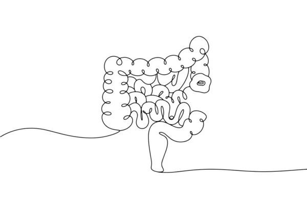 Bağırsağın bir kısmını almak ve stoma yaratmak için ameliyat. Bir insanın hayatını kurtarmak. Ostomy Farkındalık Günü. Farklı kullanım alanları için bir çizgi. Vektör illüstrasyonu.