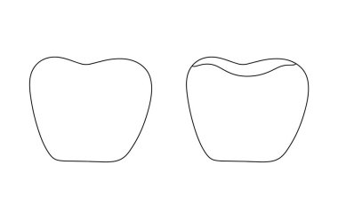 Diş tacı. Modern dişçilikte kullanılan bir implant. Farklı kullanım alanları için bir çizgi. Vektör illüstrasyonu.