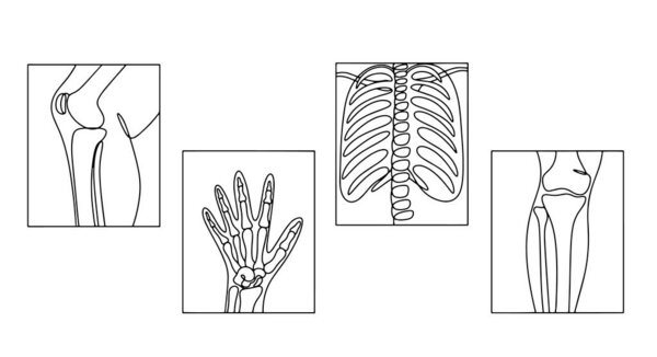 Рентгеновское изображение коленного сустава, руки, груди и колена. Международный день радиологии. Один рисунок линии для различных целей. Векторная иллюстрация.
