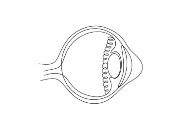 Korneanın bozulması mı? Gözüm. Keratoconus. Dünya Keratoconus Günü. Farklı kullanım alanları için bir çizgi. Vektör illüstrasyonu.