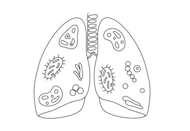 Ciğerler bakteri ve virüslerle kaplı. Zatürreenin bakteriyel nedeni. Dünya Zatürree Günü. Farklı kullanım alanları için bir çizgi. Vektör illüstrasyonu.