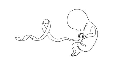 Göbek bağı AIDS kurdelesi şeklinde yeni doğmuş bir bebek. İnsanların HIV / AIDS sorununun önemine ilişkin farkındalığının bir sembolü. Dünya AIDS Günü. Farklı kullanım alanları için bir çizgi. Vektör.