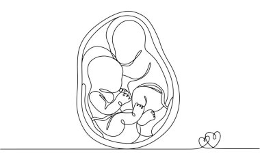 Dizygotic twins in the womb. Children with different placentas. Fraternal lickers. Twins Days. One line drawing for different uses. Vector illustration. clipart