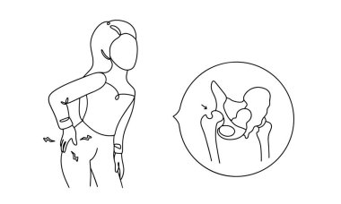 Kadın kalçasını tutuyor. Kalçasında şiddetli ağrı var. Kalça çıkığı. Beyaz arka planda basit bir çizgi çizimi. Vektör.