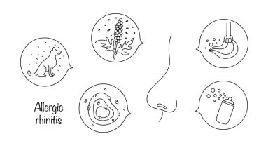 İnsan burnu ve Rhinitis 'e sebep olan ana alerji kaynakları. Bitki poleni, hayvan kılı, toz, mantar sporları ve kimyasallar yüzünden akan burun. Vektör illüstrasyonu.