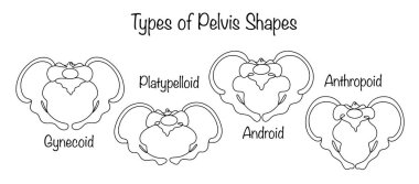 İnsan leğen kemiğinin elle çizilmiş görüntüsü. Gynecoid, android, antropoid ve ornitorenk pelvis. Leğen kemiğinin yapısı ve boyutu, doğumun gidişatı ve sonucu için çok önemlidir. Vektör.