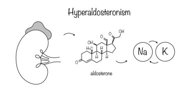 Hiperaldosteronizm. Adrenal korteksin sodyum-potasyum dengesini korumak için gerekenden daha fazla aldosteron salgıladığı bir durum. Çeşitli kullanımlar için tıbbi vektör.